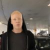 Shaun Ross If You Lose Your Hair You Can Become a JC Penny Model